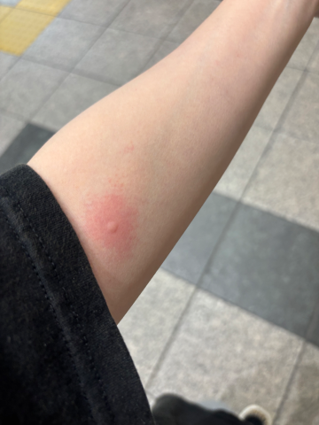 さあや の 蚊