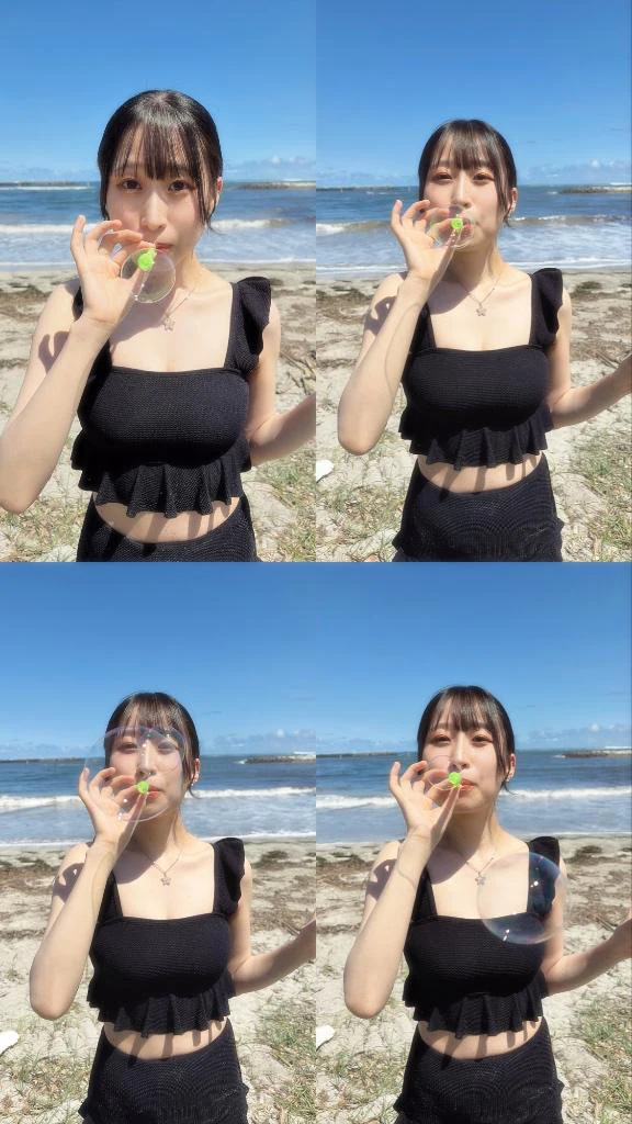 日焼けが痒すぎる👧🏽