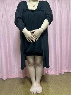 うみ