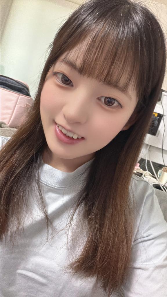 ちびとり の ついに歯列矯正が終わりました♡