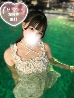 ゆるみ