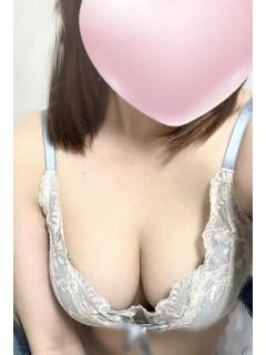 レア