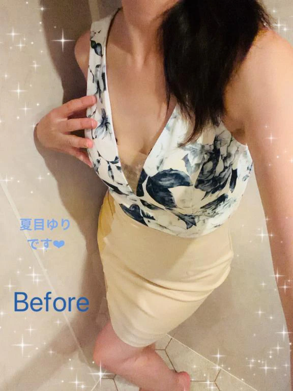 Before✨