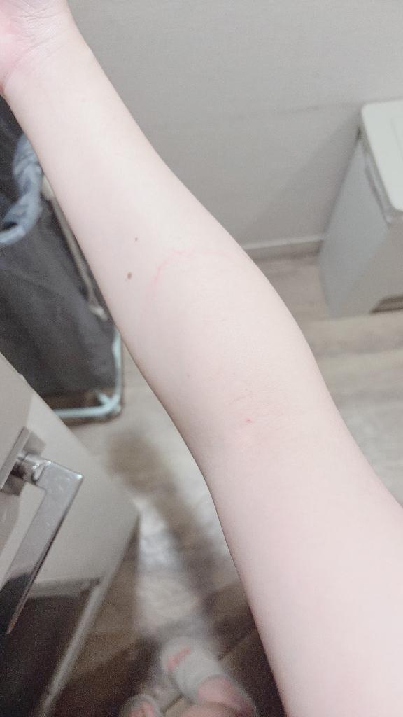 ♡ひめか♡ の 🎀痛かった話🥺